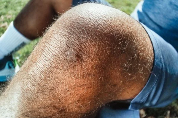 tennis knee injury
